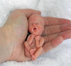 abortus7